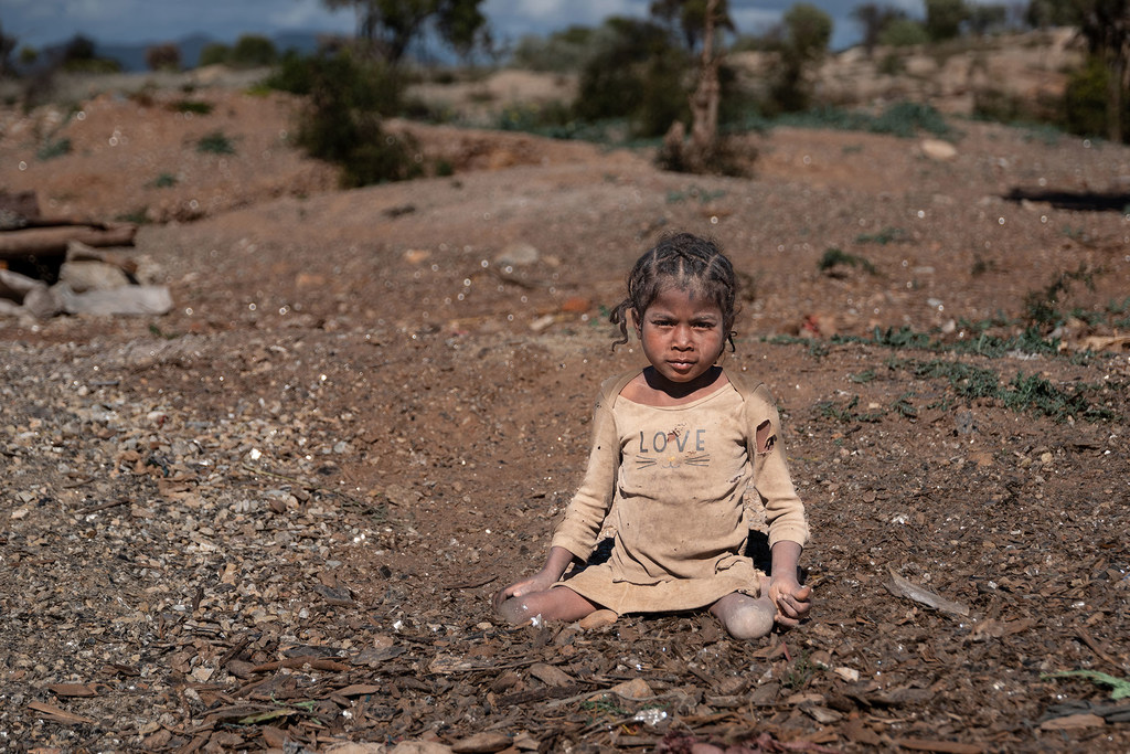 Une fillette atteinte de polio travaille dans une mine à Anosy, à Madagascar.